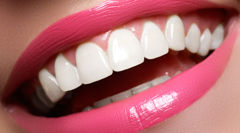 Tratamiento de blanqueamiento dental