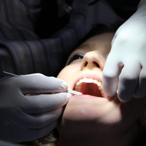 Cómo detectar a tiempo un cáncer oral